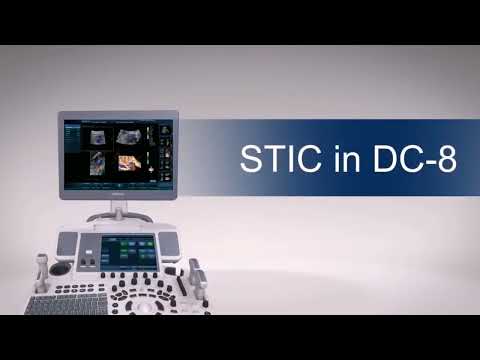 Видеообзор опции