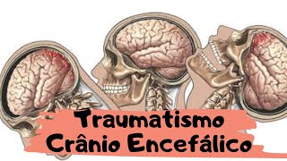 AULA 53: TRAUMATISMO CRÂNIO ENCEFÁLICO (T.C.E)