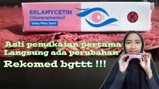 Download lagu The most effective eye ointment for children/adults || Mothers must have this at home mp3