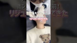 【PR】⁡弘大駅目の前のJfeelクリニックでリジュラン受けてきたよ！⁡#韓国皮膚科 #ホンデ皮膚科 #Jfeelクリニック #韓国肌管理 #韓国美容クリニック