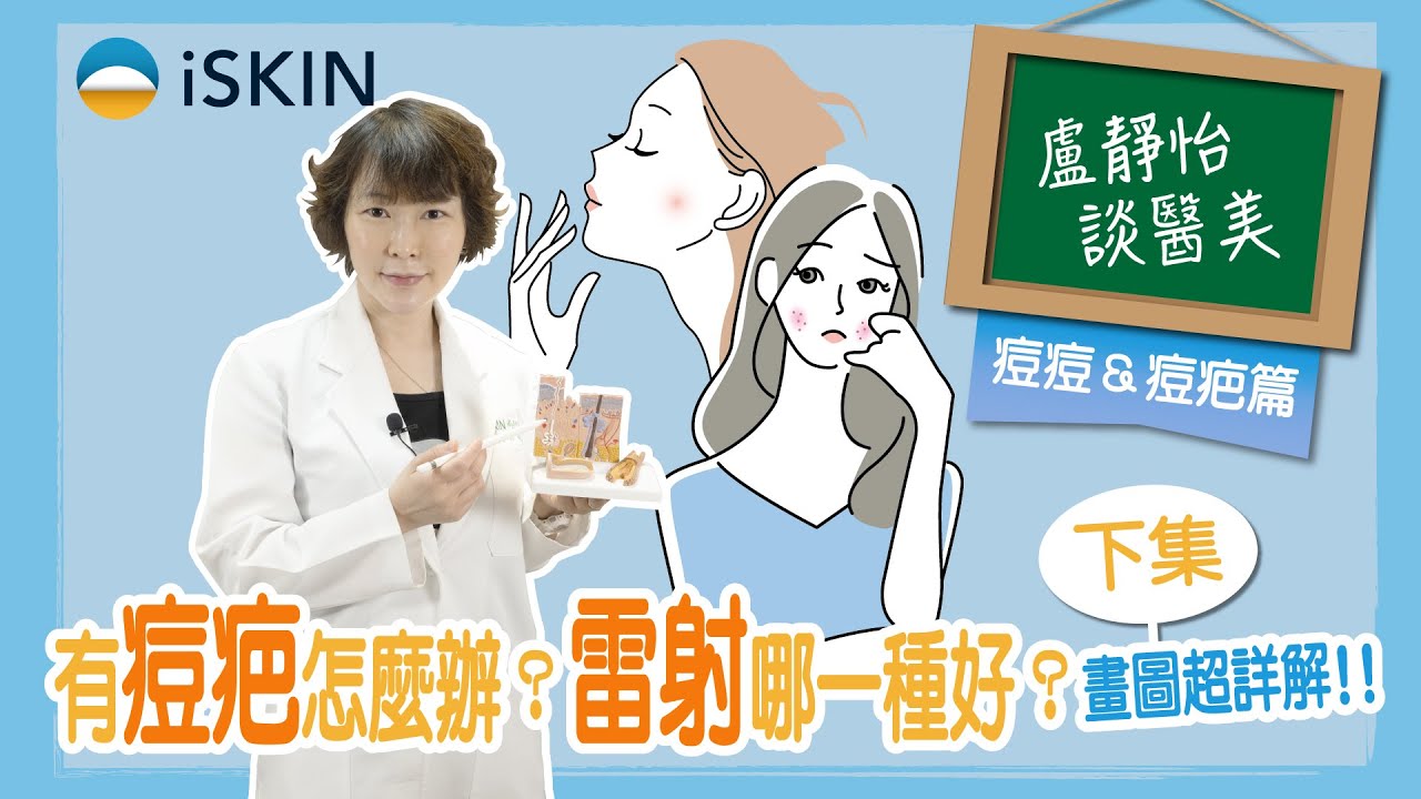 有痘疤好困擾怎麼辦？雷射除疤有用嗎？哪一種好？圖畫超詳解