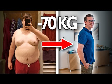 “I didn’t do any exercise” Lost 70KG!