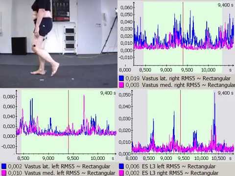 Gait Analysis with synchronized electromyography (EMG)