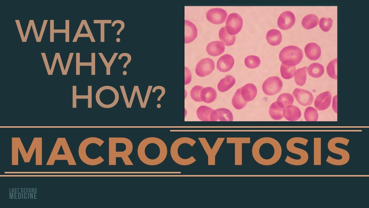 How to test for macrocytosis? Tipseri