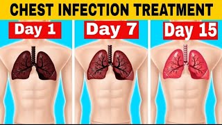 5 Home Remedies For Chest Infection | Dr Vivek Joshi