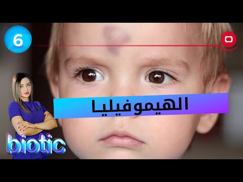 شاهد بالفيديو.. الهيموفيليا - م٢ - Biotic - الحلقة ٦