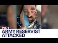 Man attacked during night run | FOX6 News Milwaukee