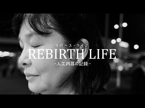 人工内耳について詳しく解説