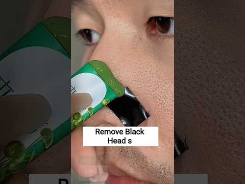 Black Head Removal nose mask#blackheadremoval #skincare #ytshorts #viralvideo #viralshorts