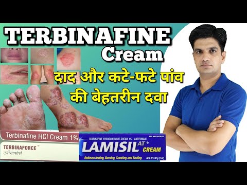 Terbinafine hcl cream