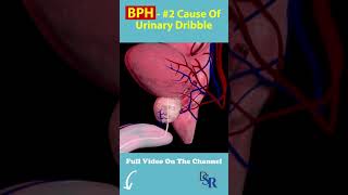 The #2 Cause Of Urinary Dribble