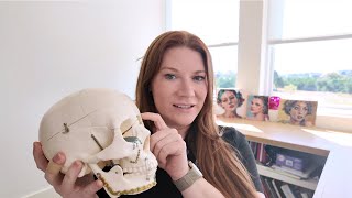 Do You Have a Neanderthal Forehead How Brow Bone Reduction Can Help With A Prominent Brow Ridge