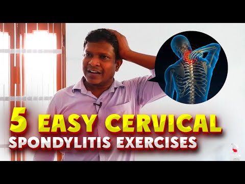 Stop Neck Pain Now! 5 Easy Cervical Spondylitis Exercises