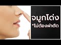 โบท็อก ปีกจมูก