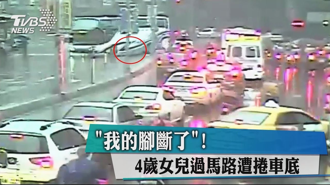 「我的腳斷了」！　4歲女兒過馬路遭捲車底