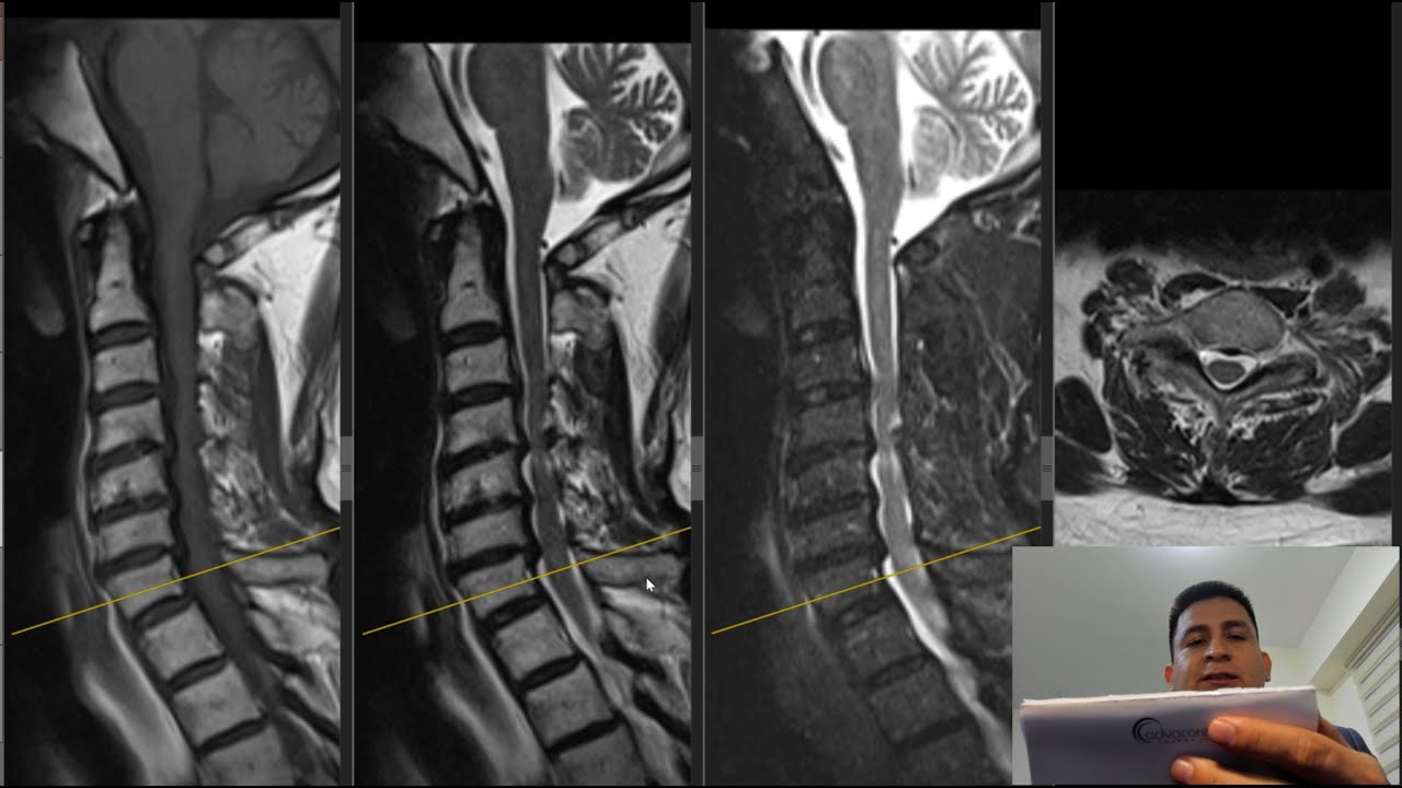 David Tafur Muñoz-2461