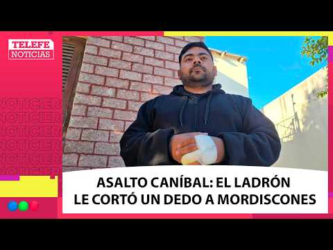 ASALTO CANÍBAL: LE AMPUTARON UN DEDO A MORDISCONES