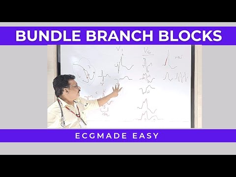 ECG MADE EASY || BUNDLE BRANCH BLOCK