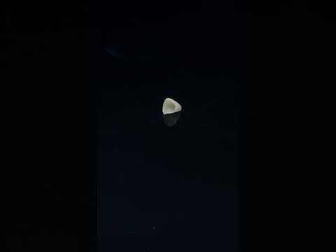 YouTube 썸네일