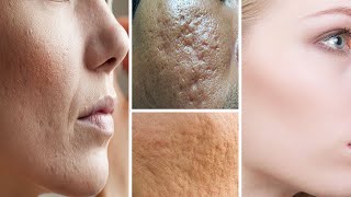 Mit nur einer kleinen Zutat verkleinerst du unschöne große Poren