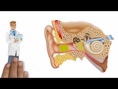 comment guerir oreille interne