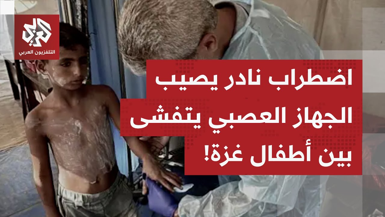 ارتفاع بعدد الإصابات بمرض غيلان باريه.. ما هو هذا المرض وكيف يتم التعامل معه ف