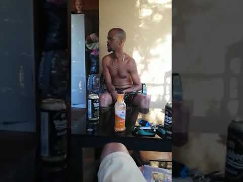 After breaking his Arm