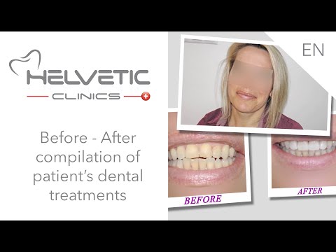 Videos from Helvetic Clinics
