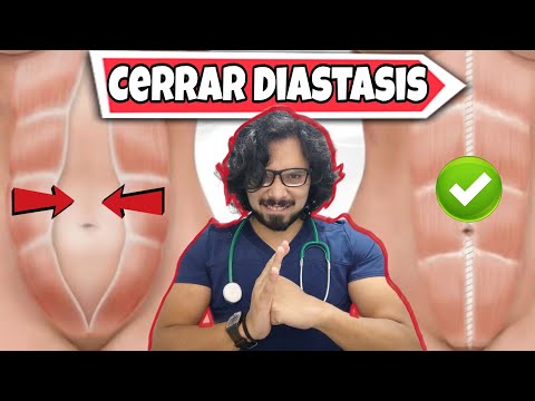 Home Exercise Routine to CLOSE ABDOMINAL DIASTASIS (diastasis recti)