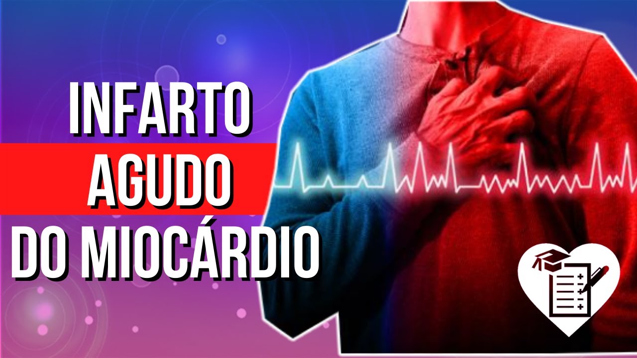 INFARTO AGUDO DO MIOCÁRDIO - Causas, Sintomas e Tratamento