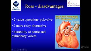 Choice of aortic valve replacement in young patients – Mr Peter Skillington