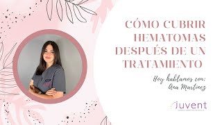 Cómo cubrir hematomas después de un tratamiento médico estético.