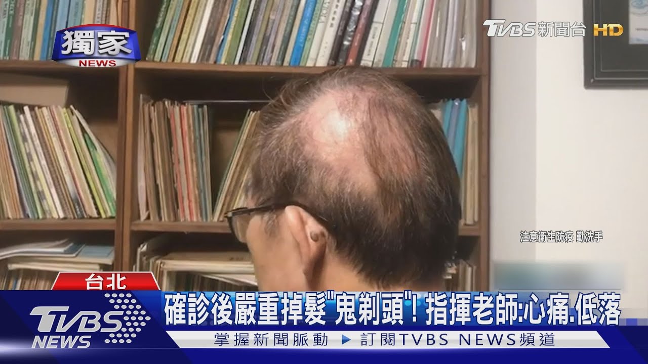 確診後嚴重掉髮「鬼剃頭」！　指揮老師：心痛、低落