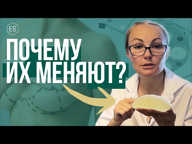 ЗАМЕНА ГРУДНЫХ ИМПЛАНТОВ. Причины, последствия и что будет, если УДАЛИТЬ ГРУДНОЙ ИМПЛАНТ?