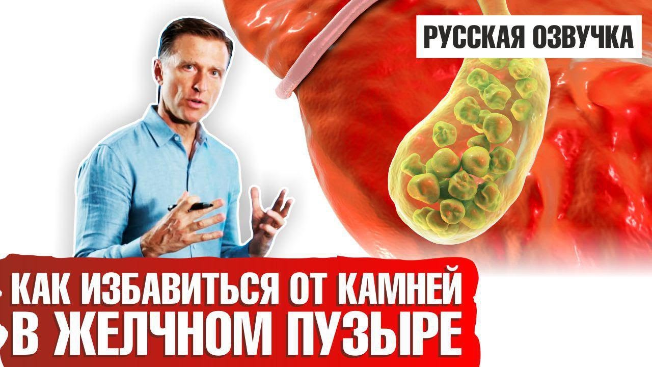 Камни в желчном пузыре: Как избавиться