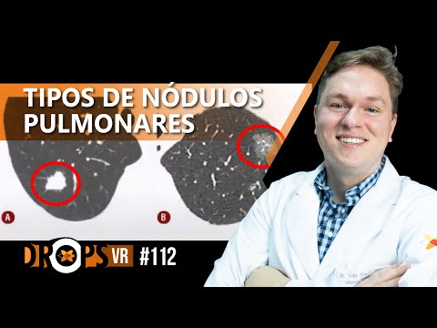 QUAIS SÃO OS TIPOS DE NÓDULOS NA TC DO TÓRAX? I VOCÊ RADIOLOGISTA