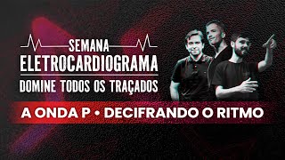 Semana ECG - A Onda P