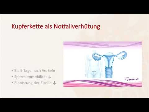 Kupferkette Gynefix hormonfreie Verhütung in Berlin - Frauenarztpraxis am Potsdamer Platz