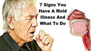 Signs And Symptoms Of Mold Exposure!