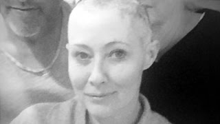 Top 10 Amazing Celebrities Who Have or Had Breast Cancer | Rita Wilson