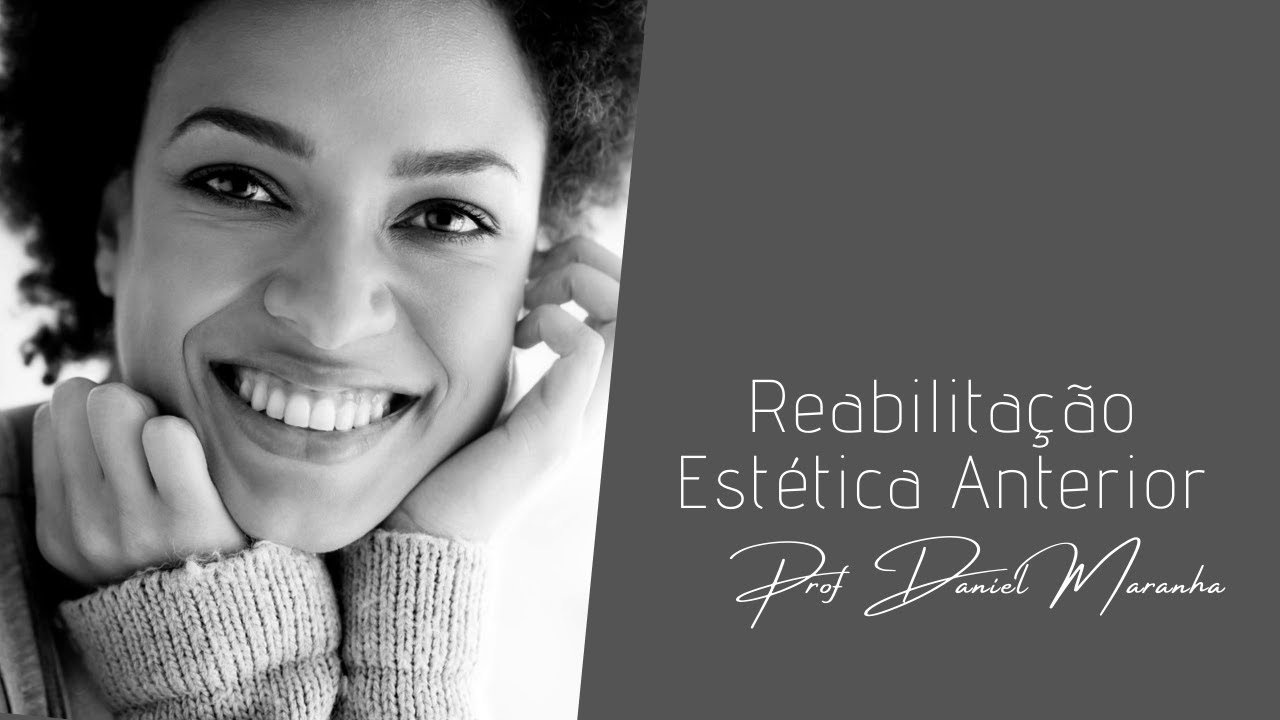 Reabilitação Estética Anterior