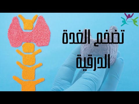 Mieux vaut prévenir que guérir – Épisode 10 – Hypertrophie de la glande thyroïde