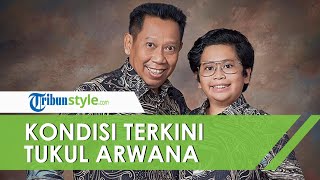 Kondisi Tukul Arwana Membaik, Akan Jalani Fisioterapi hingga Konsumsi Obat Pemulihan Stroke