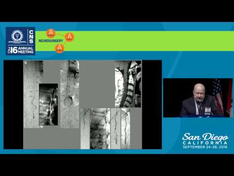 Spinal Dural Arteriovenous Fistulas: 40 Years of Progress - Unanswered Issues