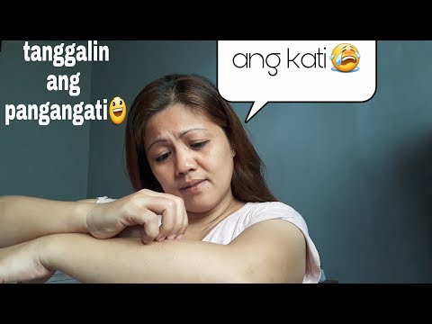 Halamang-singaw sa mga sintomas ng kuko paa Ekzoderil presyo daisy