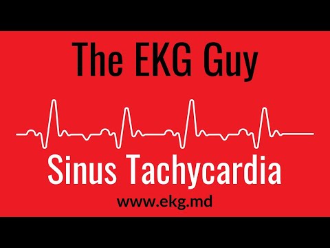 Sinus Tachycardia EKG l The EKG Guy - www.ekg.md