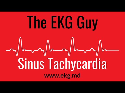 sinus tachycardia magas vérnyomás