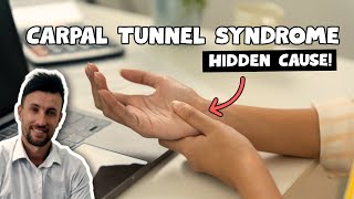 The Hidden Cause of Carpal Tunnel Syndrome