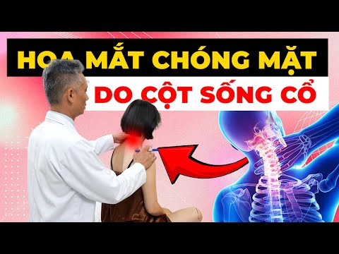 Hoa Mắt Chóng Mặt Cả Ngày? Cảnh Báo Nguy Hiểm Từ Cột Sống Cổ