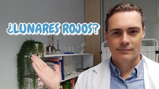 Dermatólogo aclara las dudas sobre los angiomas capilares o puntos rubí